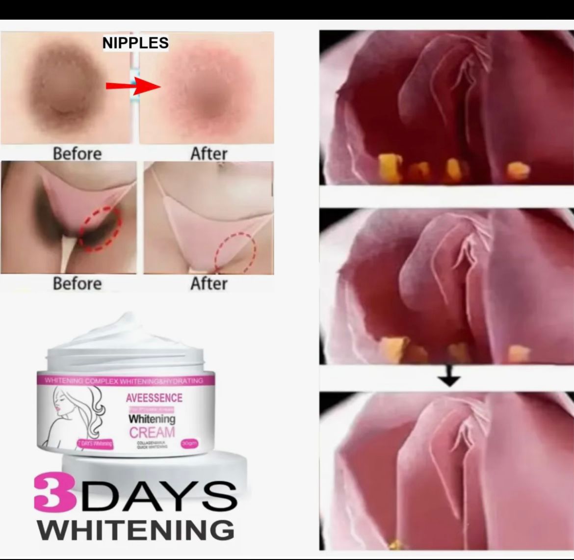 Pr*vate-s Part-s White-ning Cream