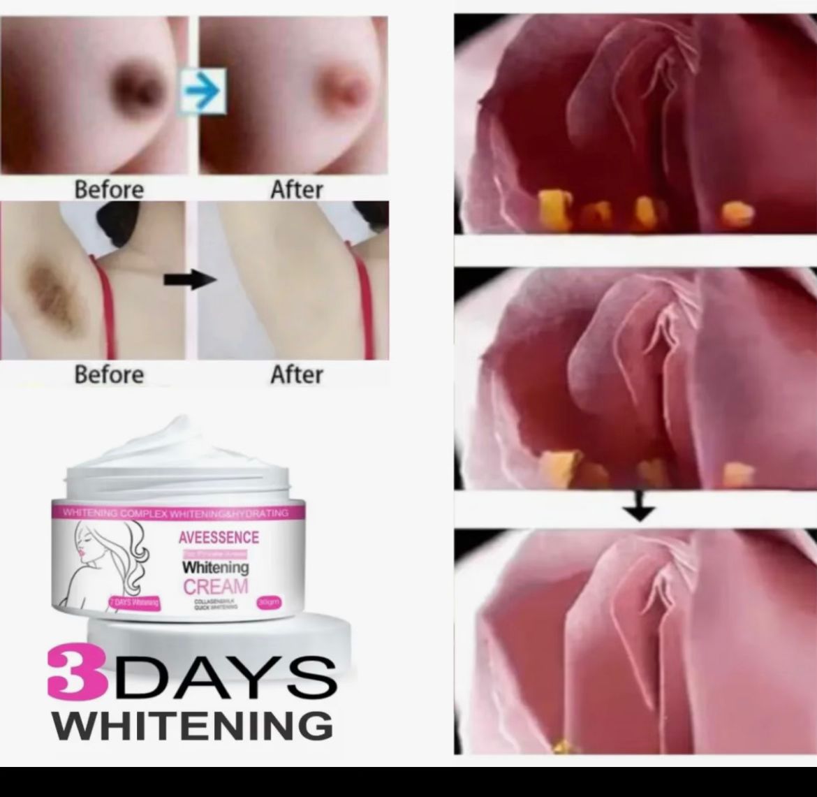 Pr*vate-s Part-s White-ning Cream